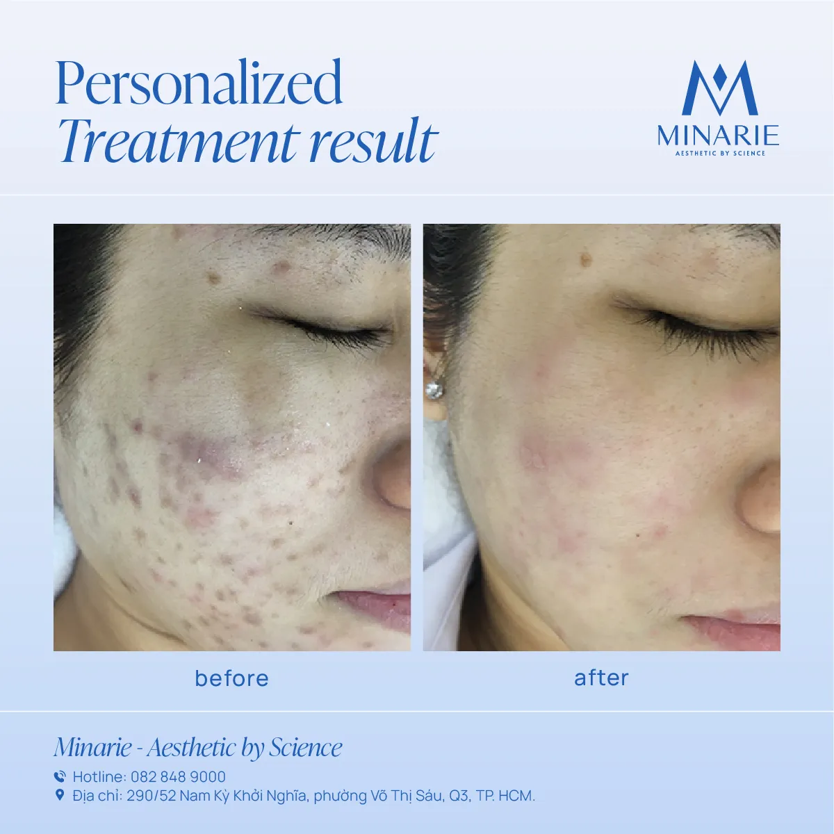 Kết quả điều trị