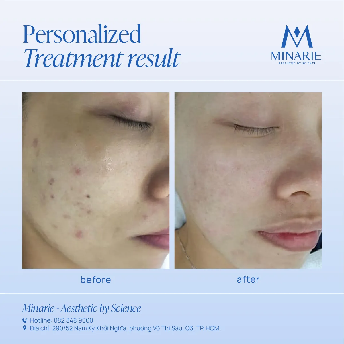 Kết quả điều trị