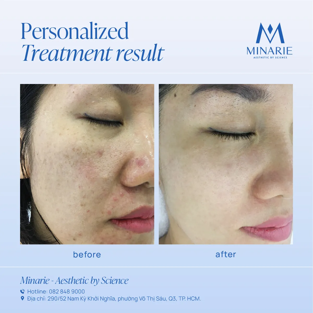 Kết quả điều trị