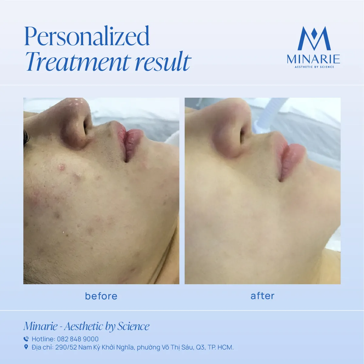 Kết quả điều trị