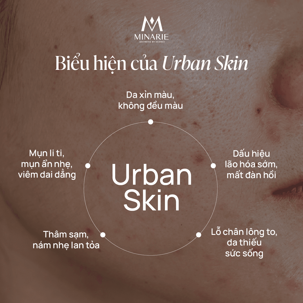 Làn Da Đô Thị Là Gì? - Location