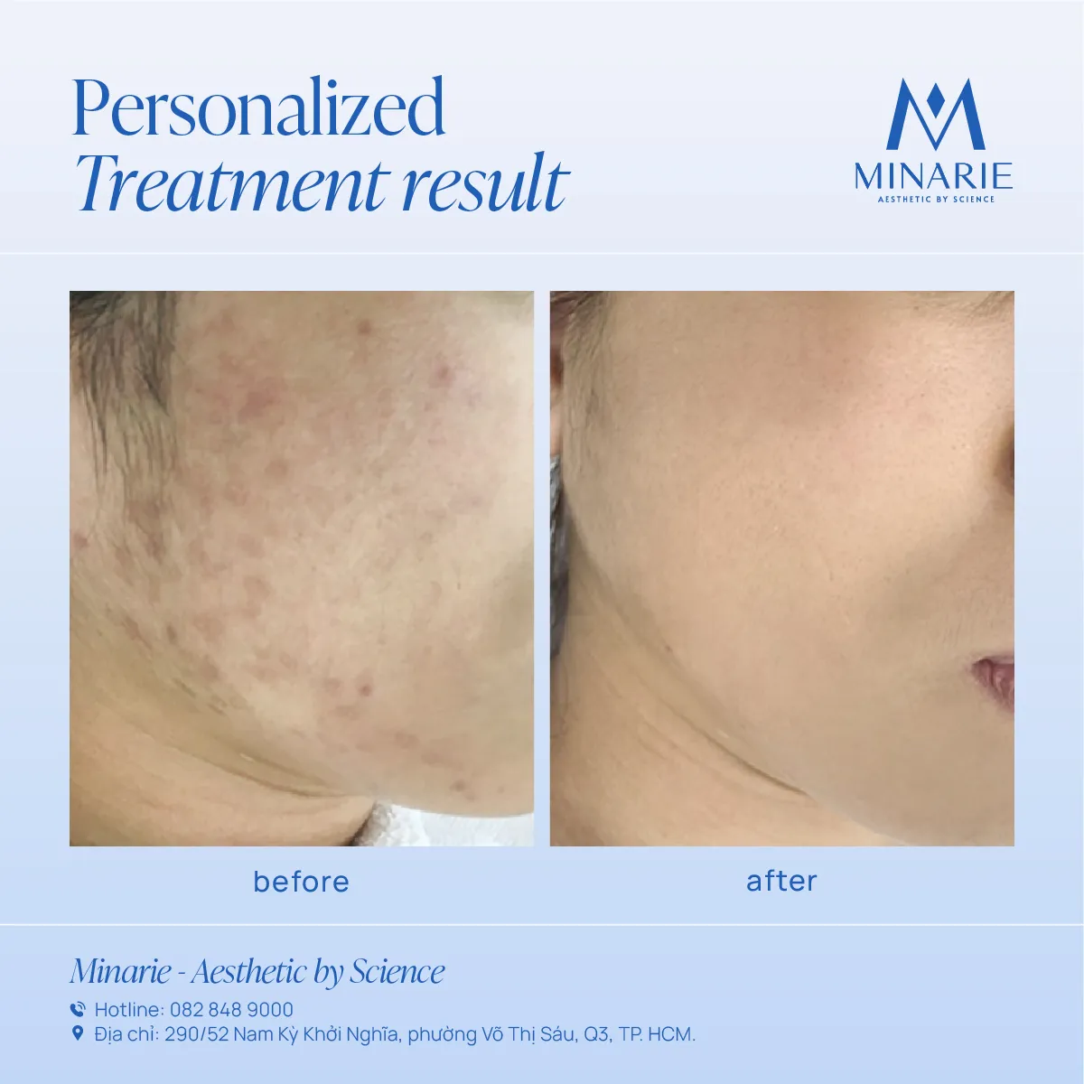 Kết quả điều trị